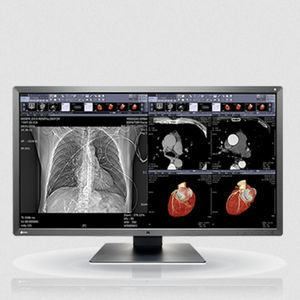 moniteur IPS LCD 1