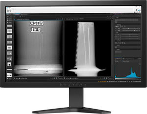 logiciel de visualisation d'images rayons X