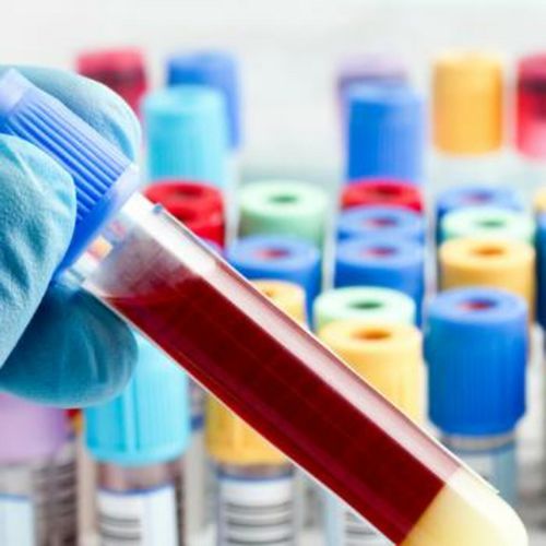 Additif pour l'industrie pharmaceutique - Celpure® - Imerys Ceramics  - de diatomées / à haute pureté