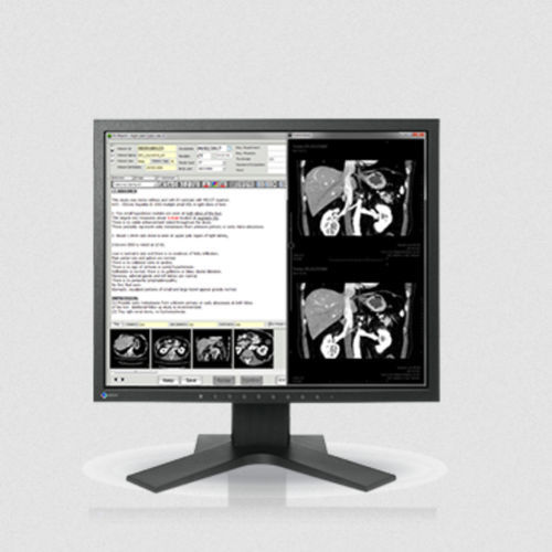 Moniteur LCD - MX194 - EIZO NANAO - rétroéclairage à LED / numérique / pour le médical