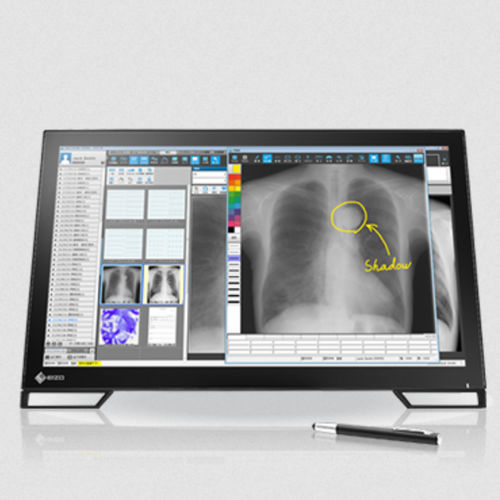 Moniteur IPS LCD - MS236WT series - EIZO NANAO - à écran tactile capacitif PCAP / à écran tactile multi-points / rétroéclairage à LED