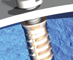Insert fileté - Foamsert® - TAPPEX - de laiton / plat