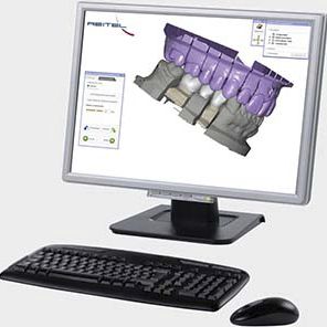 Logiciel d'interface - exocad  - Reitel - de conception / de planification / dentaire
