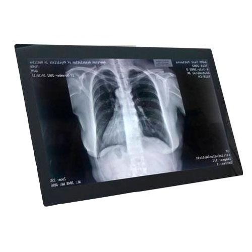 Moniteur pour le médical - HSINTEK Electronics Co., Ltd - LCD / rétroéclairage à LED / Full HD