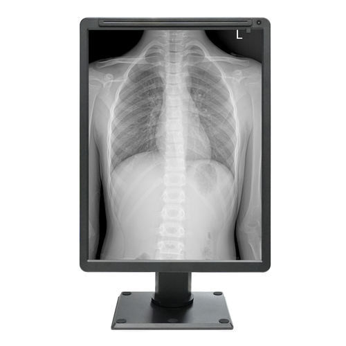 Panneau d'affichage médical - MDC-G2201 - ZRT Technology - monochrome / 21.3" / HDMI