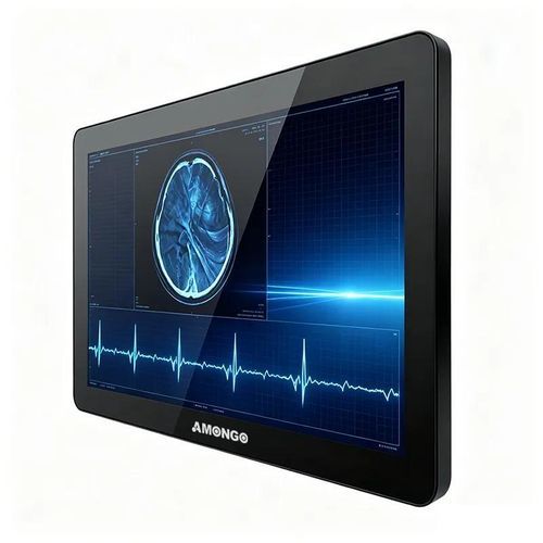 Moniteur avec écran tactile - AMG-15OPTD01G1 - AMONGO Display Technology(ShenZhen)Co.,LTD - rétroéclairage à LED / pour le médical / 15.6"