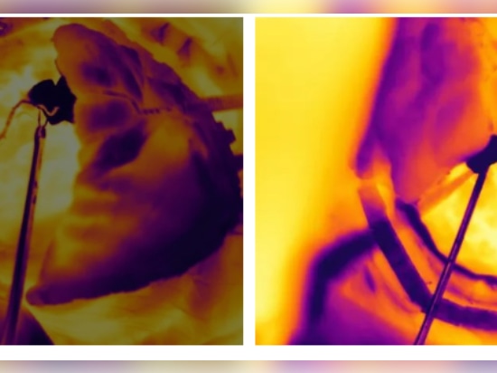 Caméras thermiques infrarouges utilisées pour la surveillance médicale et sanitaire