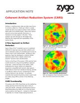 Coherent Artifact Reduction